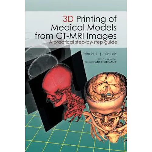 3D Printing of Medical Models from CT-MRI Images: A Practical step-by-step guide - Paperback