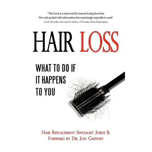 Hair Loss: What to do if it Happens to You - Paperback