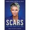Scars - What Drs. Didn't Tell Them - Hardcover