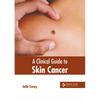 A Clinical Guide to Skin Cancer - Hardcover