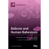 Babesia and Human Babesiosis - Hardcover