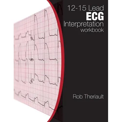 12-15 Lead ECG Interpretation: Workbook - Paperback