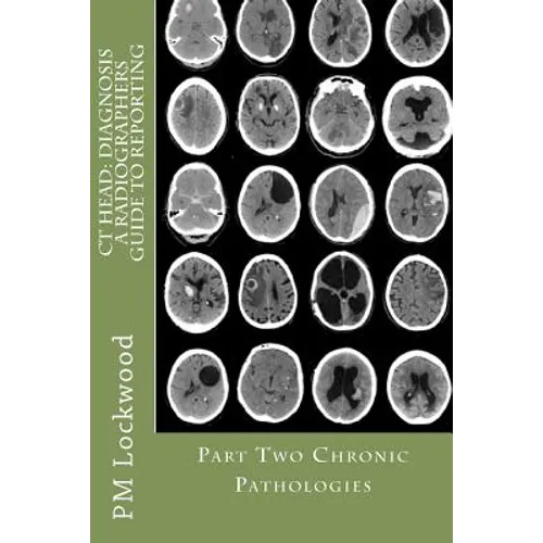 CT Head: DIAGNOSIS A Radiographers Guide To Reporting Part 2 Chronic Pathologies: Part 2 Chronic Pathologies - Paperback