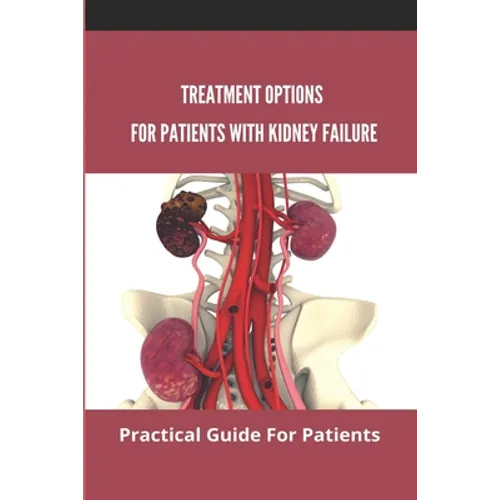 Treatment Options For Patients With Kidney Failure: Practical Guide For Patients: Pros And Cons Of Kidney Transplant - Paperback