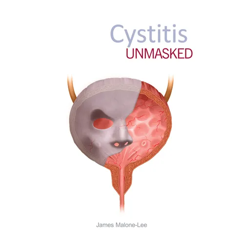 Cystitis Unmasked - Paperback