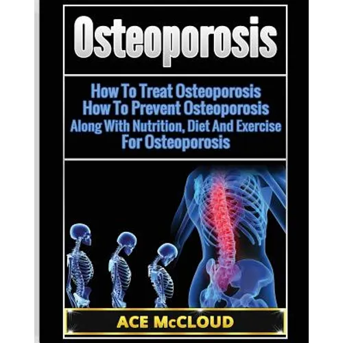 Osteoporosis: How To Treat Osteoporosis: How To Prevent Osteoporosis: Along With Nutrition, Diet And Exercise For Osteoporosis - Paperback