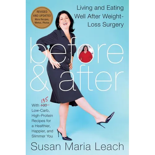 Before & After, Revised Edition (Revised) - Paperback
