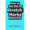 How to Get Rid Of Stretch Marks Naturally - Paperback